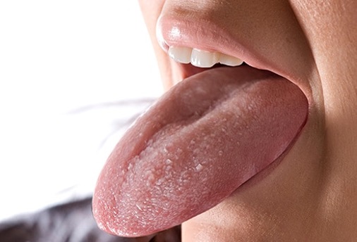 A Clean Tongue Promotes Good Oral Health & Well Being