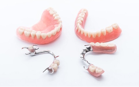 Dental Implants: A Life Changing Option For Denture Wearers