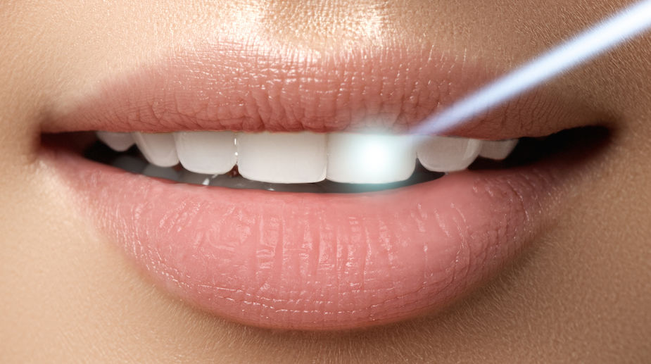 Laser Technology Will Be The Gold Standard In Dental Treatment