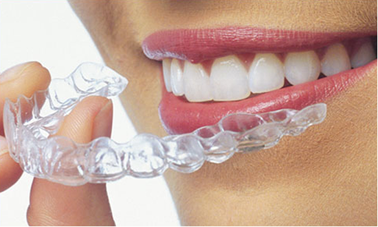 Straighter & Healthier Teeth Without Metal Braces