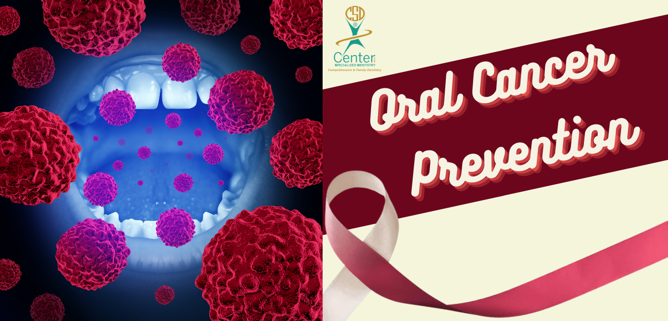 Oral Cancer Prevention