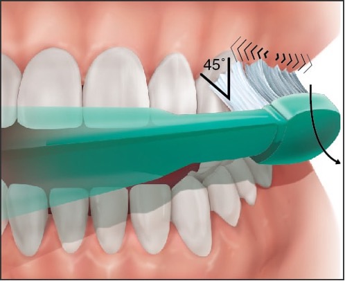 What Can You Do About Sensitive Teeth?