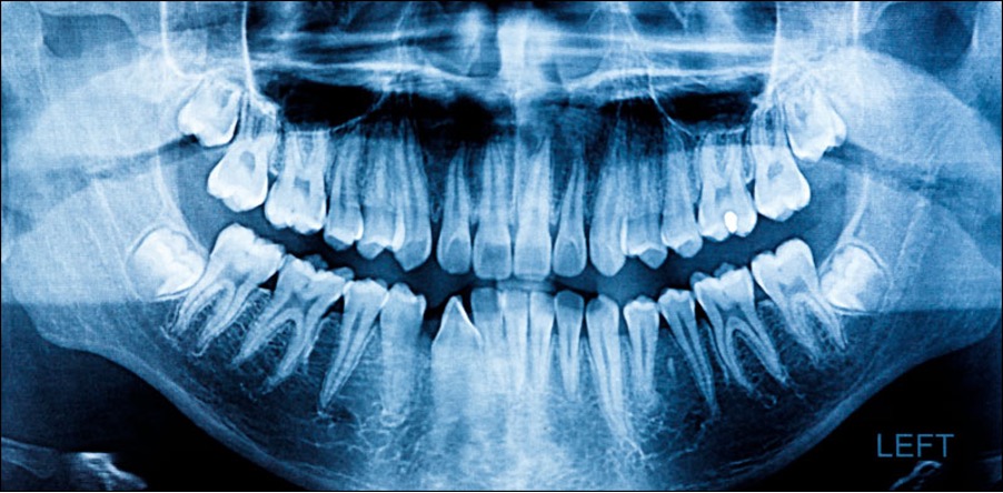 Most Important Dental Exam: The Comprehensive Dental Consultation