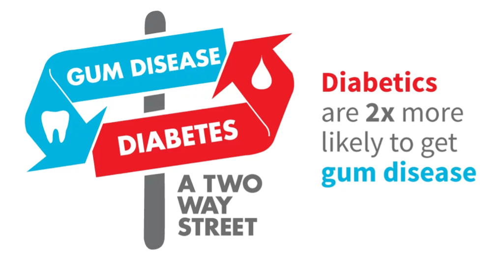 Strong Connection Between Gum Disease and Diabetes