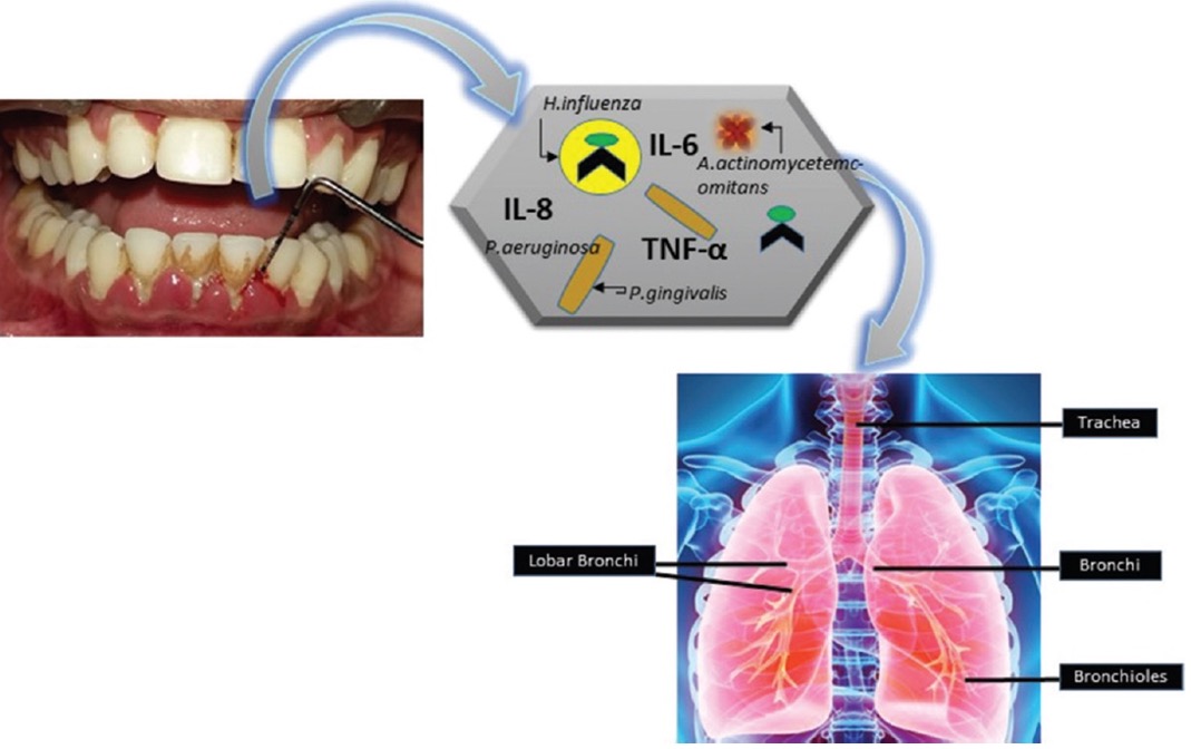 The Link Between Lung Conditions & Oral Health