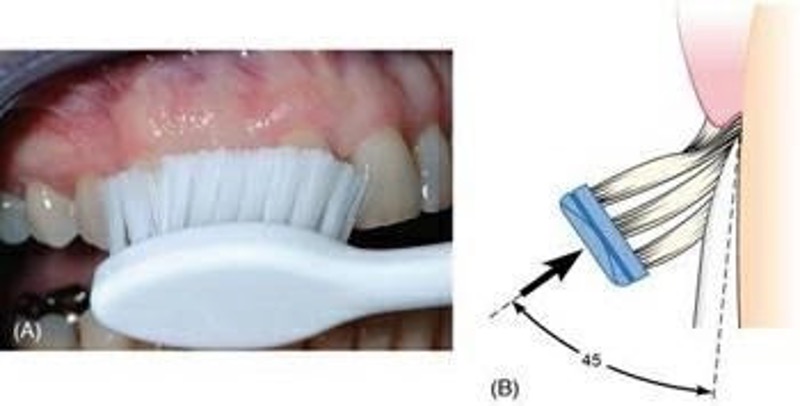 More Common Mistakes Made With Toothbrushing