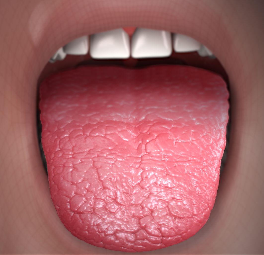 Dry Mouth Is Killing Your Teeth