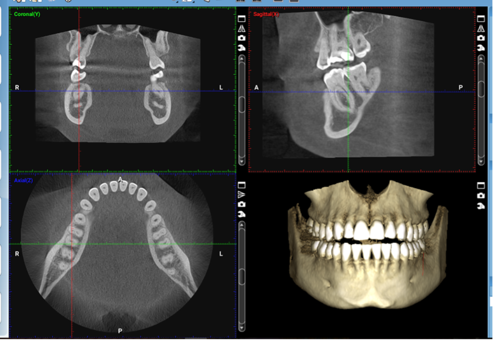 An Accurate Diagnosis Is Key to Success in Dental Treatment