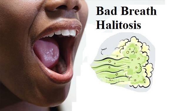 Thousands of Bahamians Suffer Chronic Bad Breath
