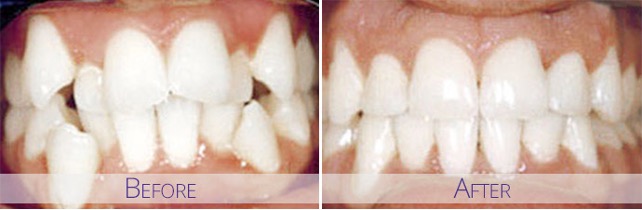 Benefits of Cosmetic Dentistry