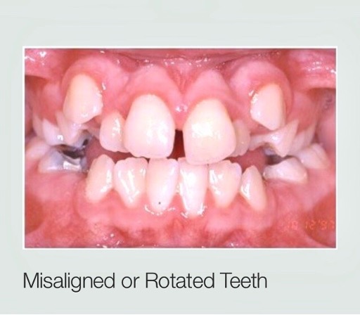 Baby Teeth Are Just As Important As Permanent Teeth