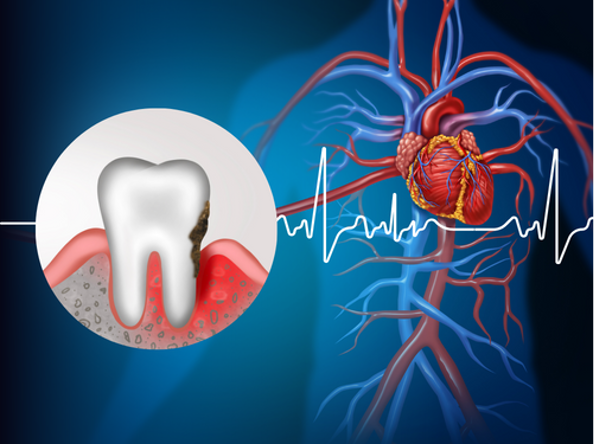 How Your Oral Health Affects Your Body