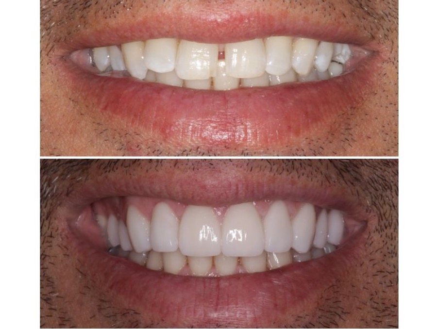 The Benefits of Cosmetic Dentistry