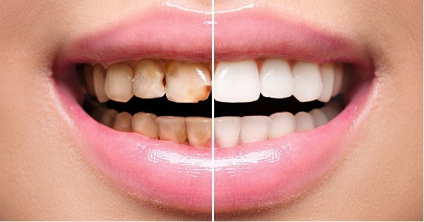 Transform Your Smile: The Power of Cosmetic Dentistry