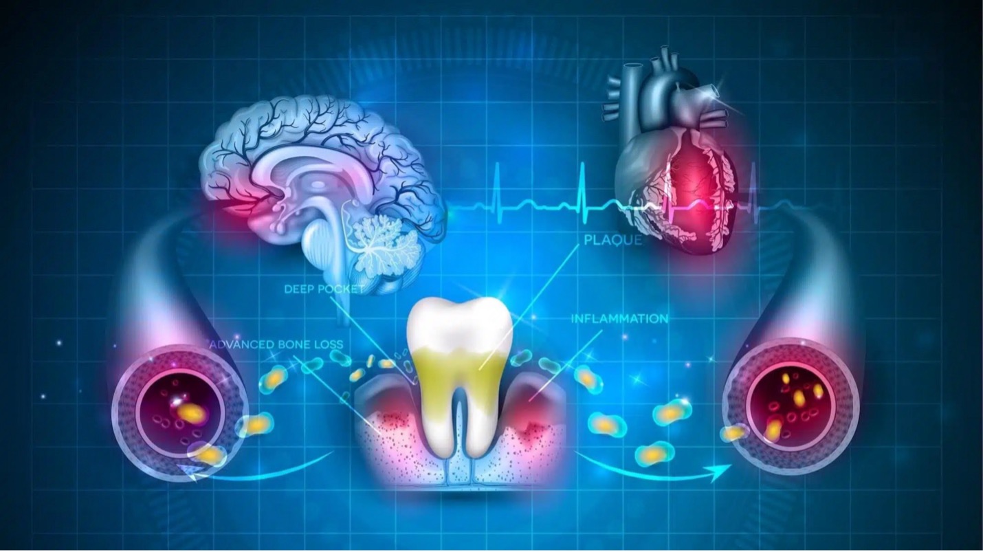 The Oral-Systemic Health Connection: Your Mouth & Your Overall Well-Being