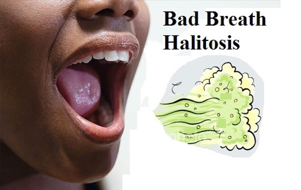 Halitosis and Bad Breath: Understanding the Causes and Effective Solutions