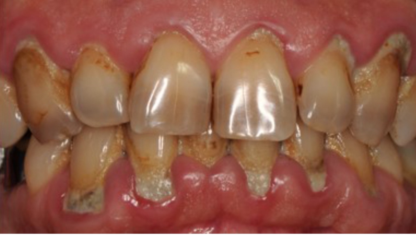 Most Common Dental Problems and Treatments: A Guide to a Healthier Smile